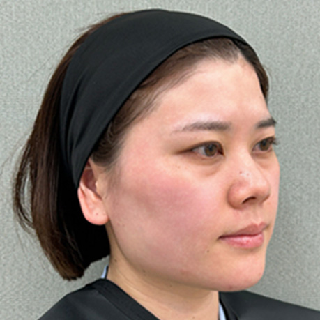 施術前